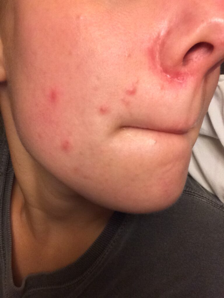 before using barefaced skincare