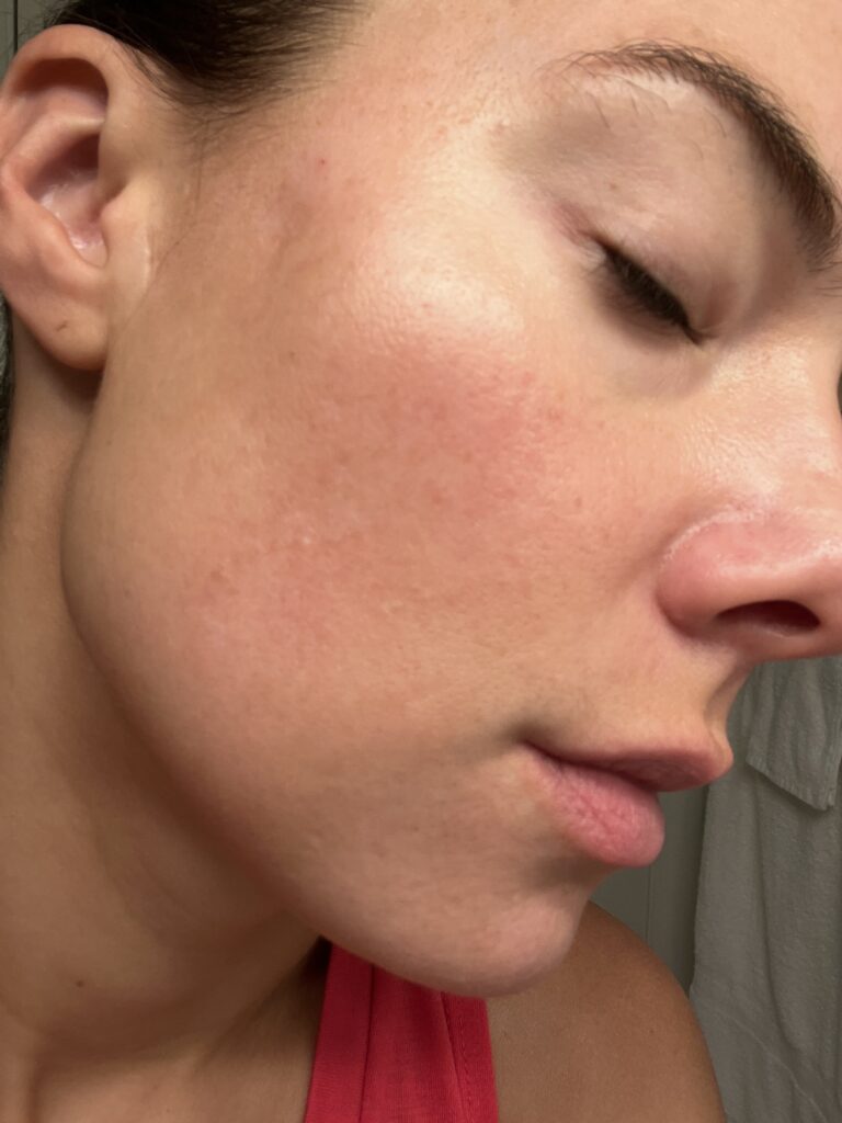 Skin after using Barefaced